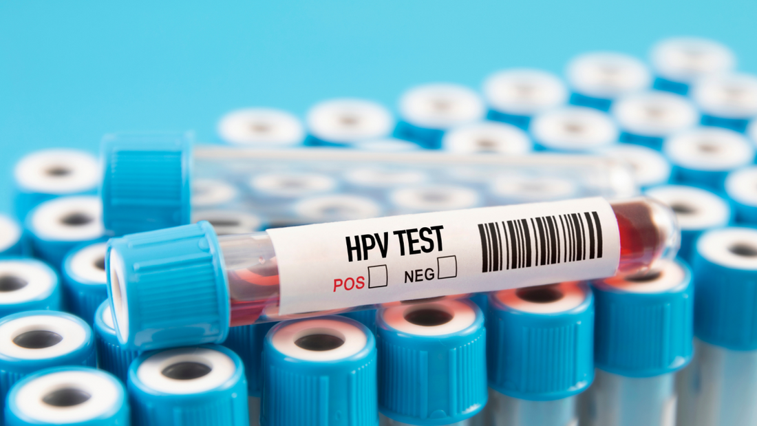 HPV Home Testing Explained: How Self-Sampling Works and Why It Matters